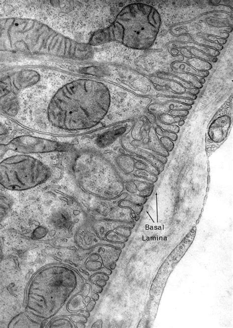 Glomerular Basement Membrane Histology