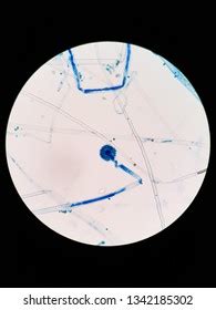 Aspergillus Flavus Under Microscope Stock Photo 1342185302 | Shutterstock