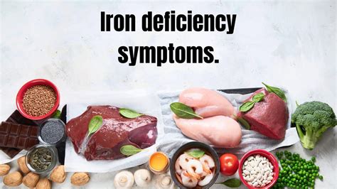 Iron Deficiency Symptoms Meltblogs