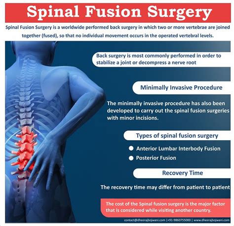 Advanced Spinal fusion Surgery in India | Spinal fusion surgery, Spinal fusion, Fusion