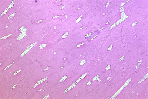 Torus Mandibularis Histology