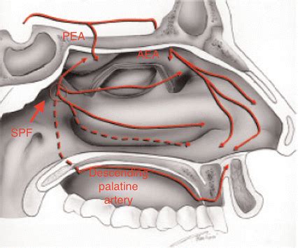 Sphenopalatine Artery Anatomy