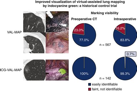 Improved Visualization Of Virtual Assisted Lung Mapping By Indocyanine