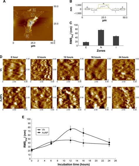 Cellular Uptake And Intracellular Spatial Distribution Of Aunps Notes