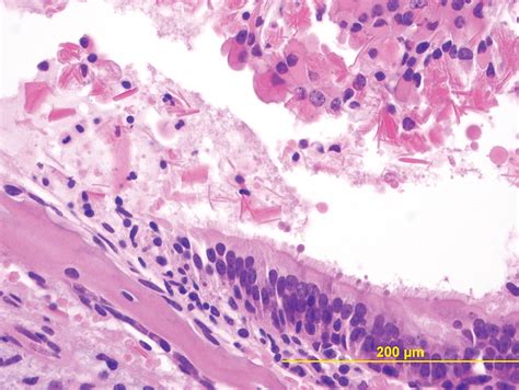 Incidence Of Spontaneous Non Neoplastic Lesions In Transgenic Cbyb6f1