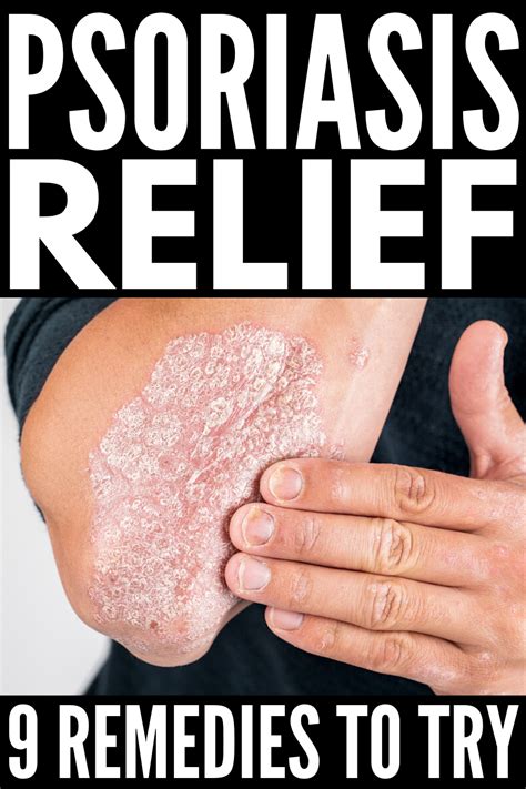 How To Get Rid Of Psoriasis 9 Tips And Remedies To Try In 2021