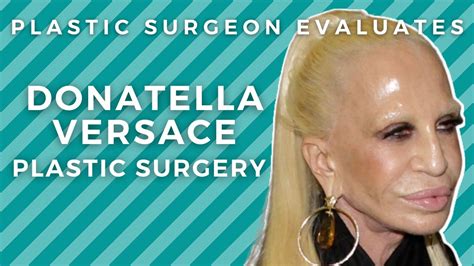 Donatella Versace Before and After Plastic Surgery: Silicone Disaster ...