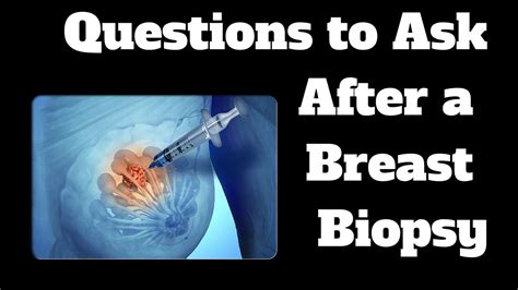 Questions To Ask After A Breast Biopsy YouTube