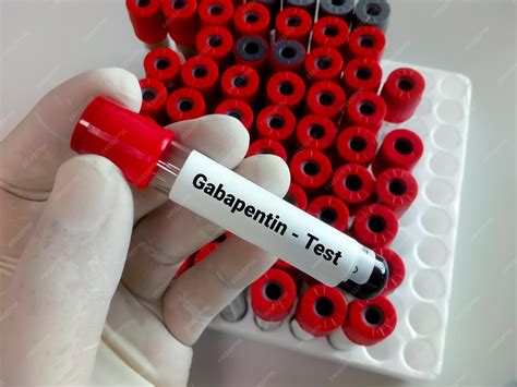 Premium Photo | Blood sample for gabapentin test to set therapeutic dose
