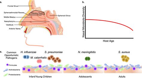 Sphenoethmoidal Recess