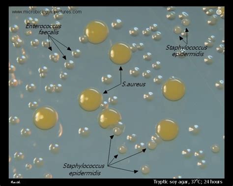 Staphylococcus Epidermidis Agar