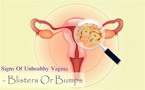 Signs Of Unhealthy Vagina That You Should Be Aware Of