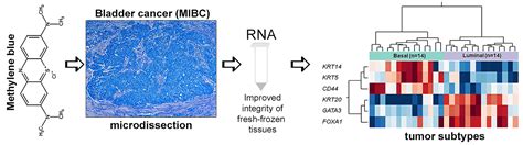 Ijms Free Full Text Improved Bladder Tumor Rna Isolation From