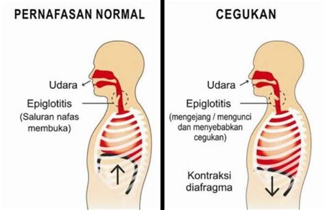 Cara Menghilangkan Cegukan Yang Praktis Untuk Dicoba