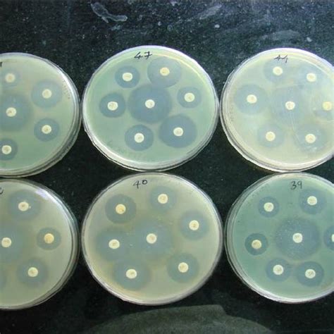 Antibiotic Resistance Pattern Of P Aeruginosa Download Scientific