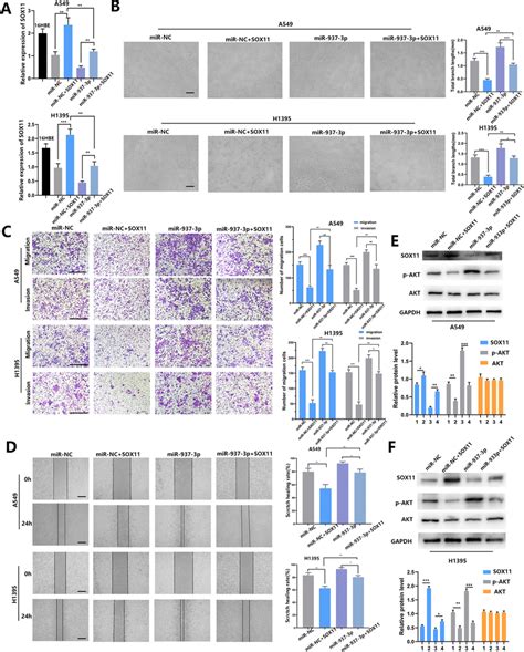 SOX11 Overexpression Reversed The Effect Of MiR 937 3p On The Malignant