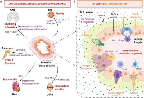 Gut Microbiota And Inflammation