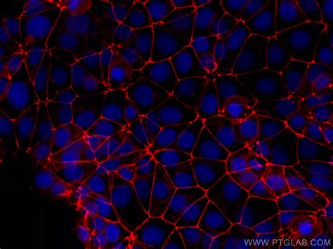 Occludin Antibody Cl Proteintech