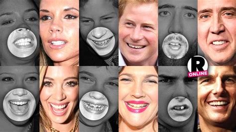 They May Be Beautiful But These Celebs Were Given A Bad Set Of Chompers