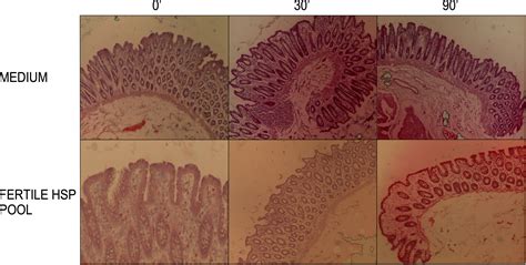 Frontiers Human Seminal Plasma Stimulates The Migration Of Cd11c