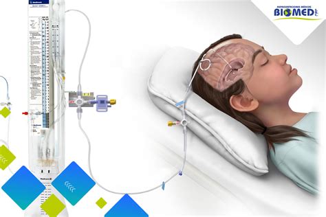 La Importancia de Medir la Presión Intracraneal en Pacientes Críticos