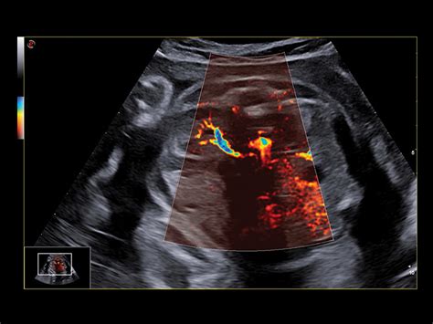 Obstetric Ultrasound Clinical Solutions - Esaote