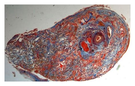 Light microscopy (trichrome staining) and immunofluorescence (S-100-red ...