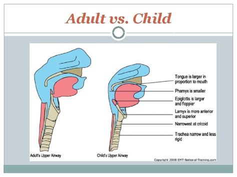 Airway Management In Pediatric Patients Pat Thorpe Msn