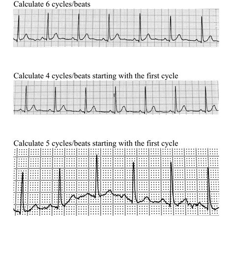 Calculate 4 cvcles/beats starting with the first | Chegg.com