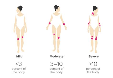 Plaque Psoriasis: Causes, Treatments, and Pictures