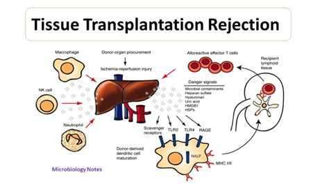 Mechanism of cellular rejection in transplantation ~ Microbiology Notes