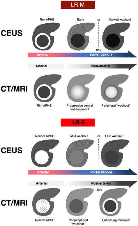 Schematics Illustrating Imaging Features Of Lr M And Major Imaging