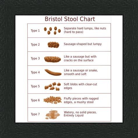 Top Bristol Stool Chart Reference Of All Time Check It Out Now Stoolz