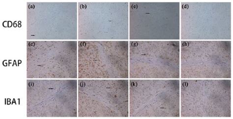 Immunohistochemical staining in the subregions of the hippocampus ... 