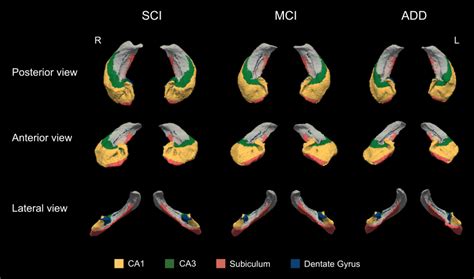 Threedimensional Representation Of Hippocampal Subfields Posterior