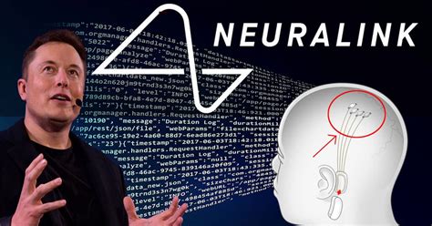 Neuralink Testes Em Humanos Podem Acontecer Em 2023