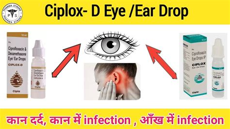 Ciplox Ciplox D Eye Ear Drops आख और कन क बकटरयल ईनफकशन क