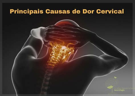 Principais Causas De Dor Cervical Dr Willian Rezende Neurologista