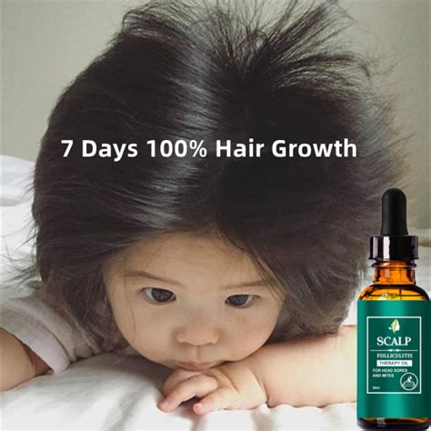 Hair Serum For Hair Growth Serum Rambut Hair Tonic For Hair Growth Anti Hair Loss Treatment Hair