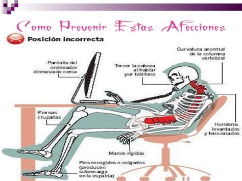 Las Consecuencias De La Mala Postura Frente Al Computador Ppt