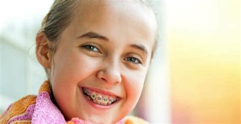 Common Types of Braces for Kids - Brodie Bowman Orthodontics