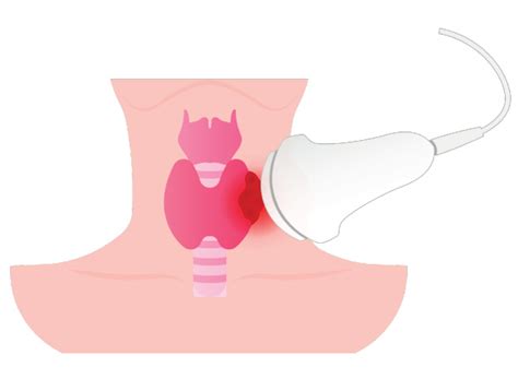 Thyroid Ultrasound – Radiology Associates