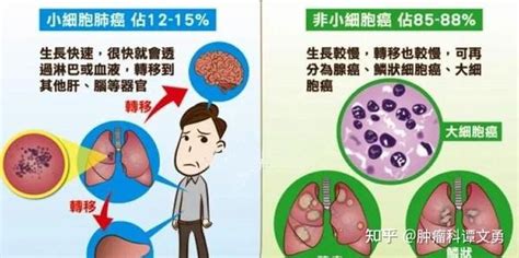 肺癌患者如何看懂病理报告？ 知乎