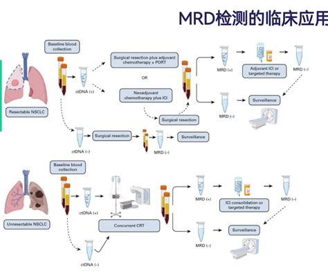 肺癌基因检测为什么需要加做mrd检测？肺癌肺癌检查 好大夫在线