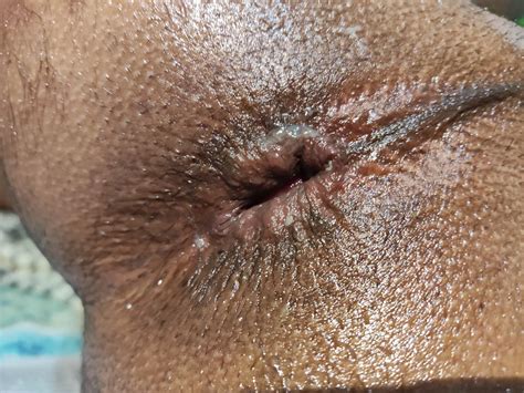 Anal Pleasure Nude Pics XHamster