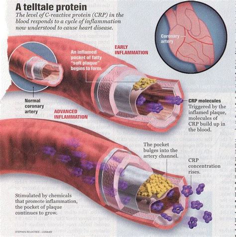 19 Medical Tests Every WOMAN Needs Health Hallie Levine And