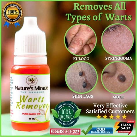 Warts Remover Original Effective Pure Kasoy Oil For Warts Kulogo Mole