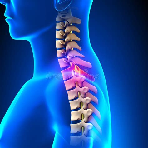 T1 Disc - Thoracic Spine Anatomy Stock Illustration - Illustration of ...