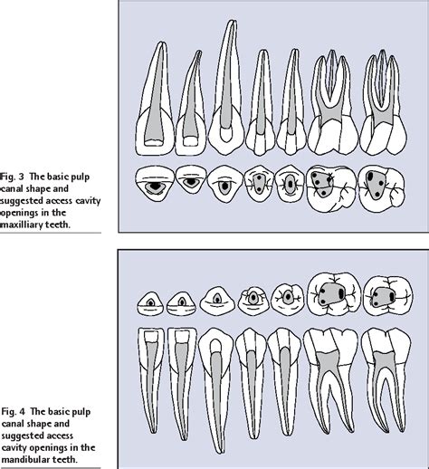 [pdf] Endodontics Part 4 Morphology Of The Root Canal System Semantic Scholar