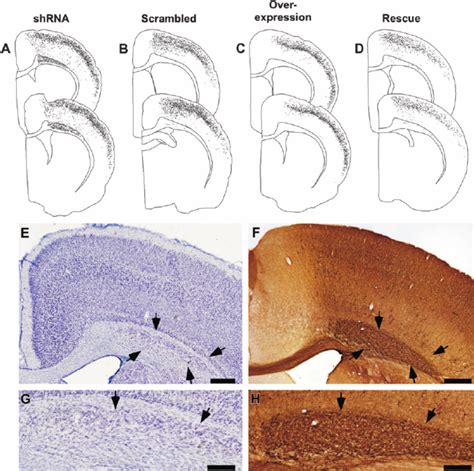 Neuronal Migration Following Embryonic Knockdown Or Overexpression Of